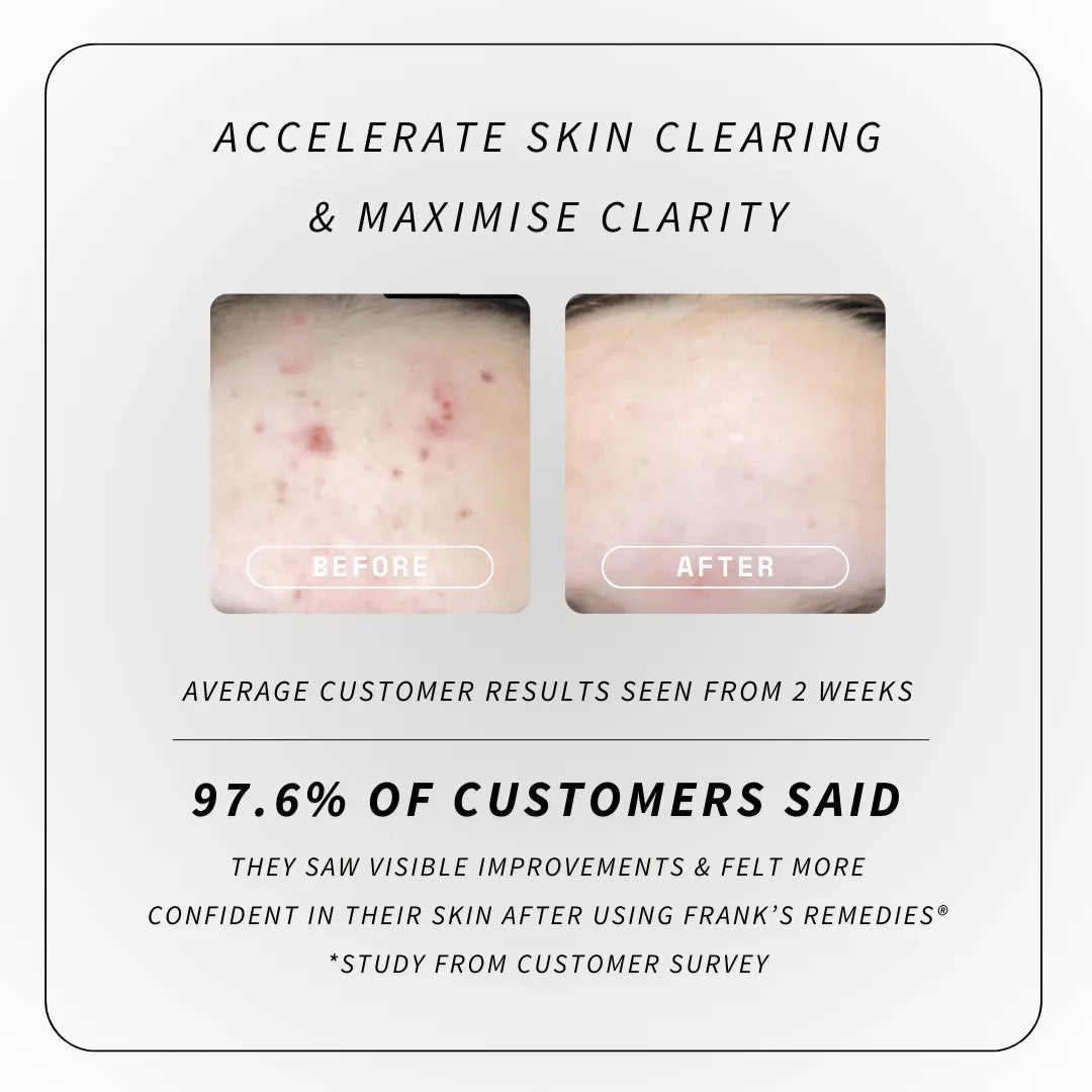 Clearing Essentials Kit customer before and after image results