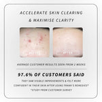 Clearing Essentials Kit customer before and after image results