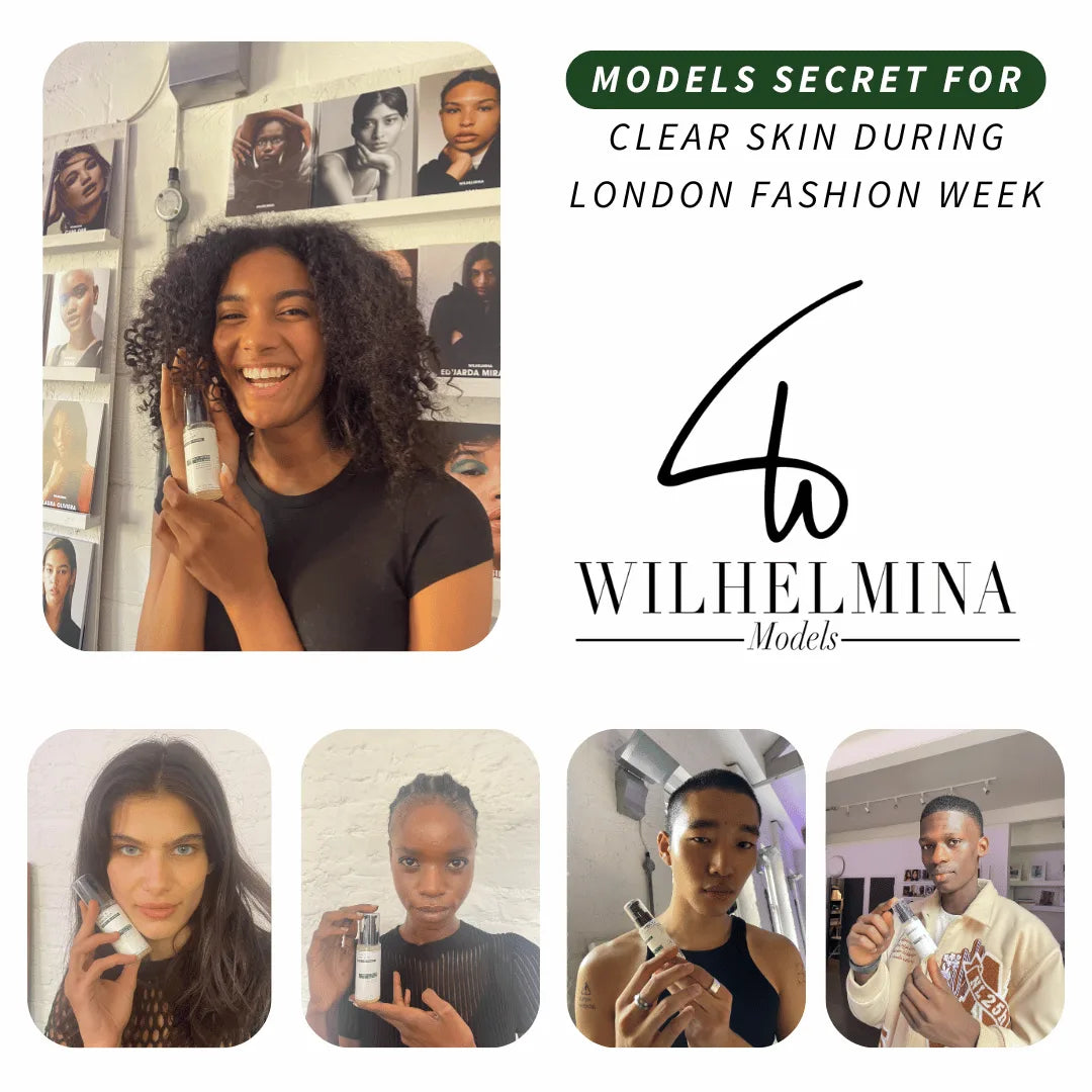 Wilhelmina Models holding Frank's remedies skincare featuring products during London Fashion Week.