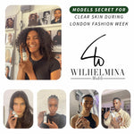 Wilhelmina Models holding Frank's remedies skincare featuring products during London Fashion Week.