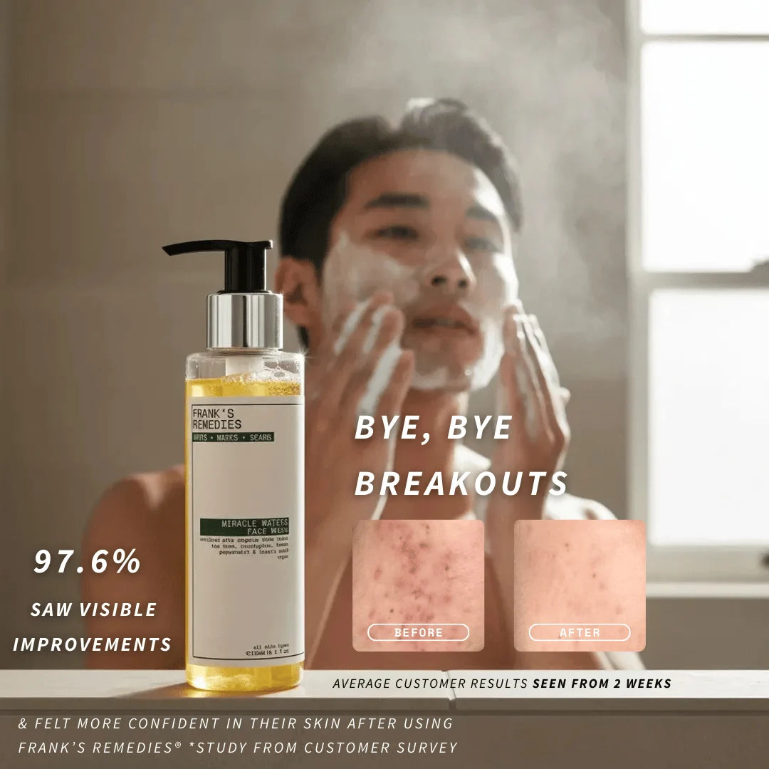 Man applying skincare product with a bottle of Frank's Remedies product displayed.