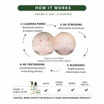 Diagram explaining Frank's 360° Clearing process "how it works" with before and after skin comparisons - Ready Steady Clear Kit